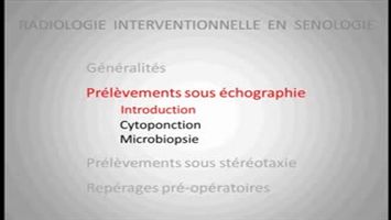 miniature_video