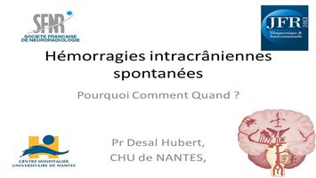 miniature_video