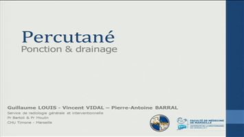 miniature_video