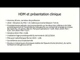 miniature_video
