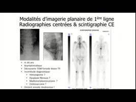 miniature_video